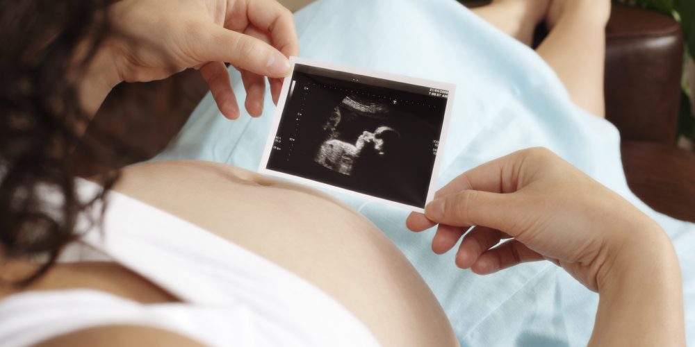 Pregnant woman sitting on sofa looking at her unborn baby's ultrasound scan